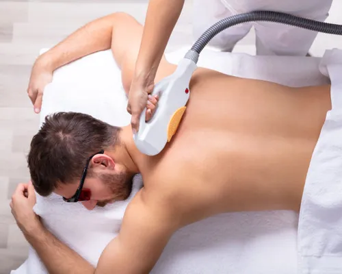 Laser Hair Removal for Men